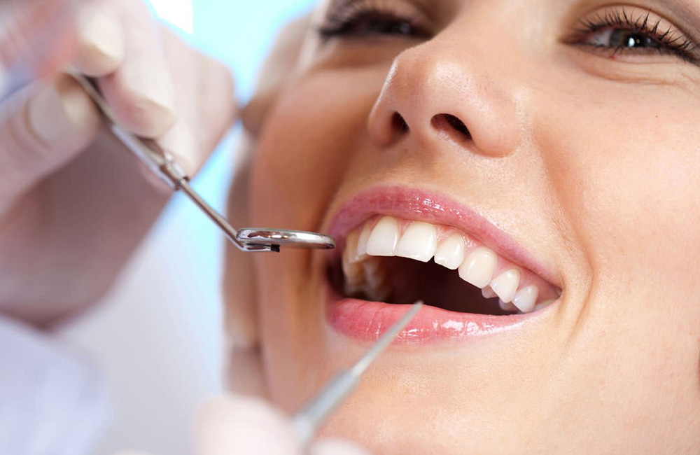CHECKUP ODONTOIATRICO